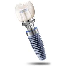 Имплантация зубов Dentium