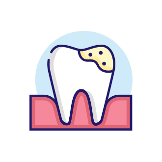 <p>Пломбирование зуба после лечения корневых каналов</p>